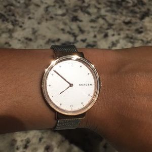 Skagen Silver and Rose Gold 2 Tone Watch